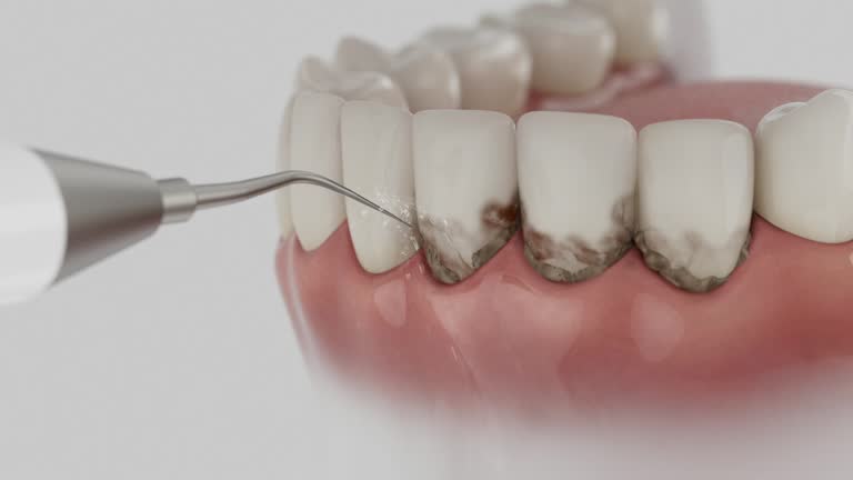 Trusted Root Canal Treatment service in Nellysford, VA - Dentist Open Now